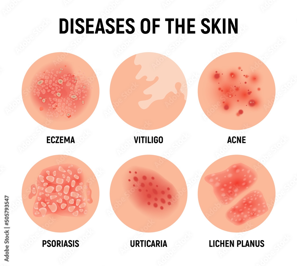 fruit rash pictures